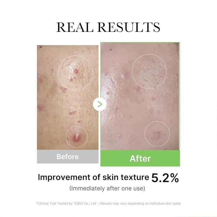 خرید سرم اگزوزوم سیکا مدی‌کیوب | Medicube Cica Serum اصل